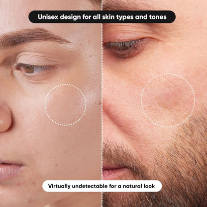 Invisible Waterproof Hydrocolloid Acne Patch for Facial Cleansing Care Essence